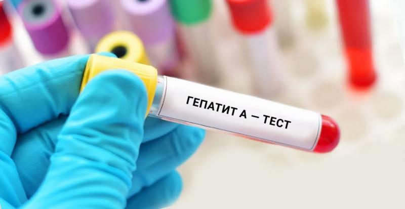 Вспышка гепатита A в Киеве: специалисты не исключают развертывания дополнительных мобильных пунктов обследования